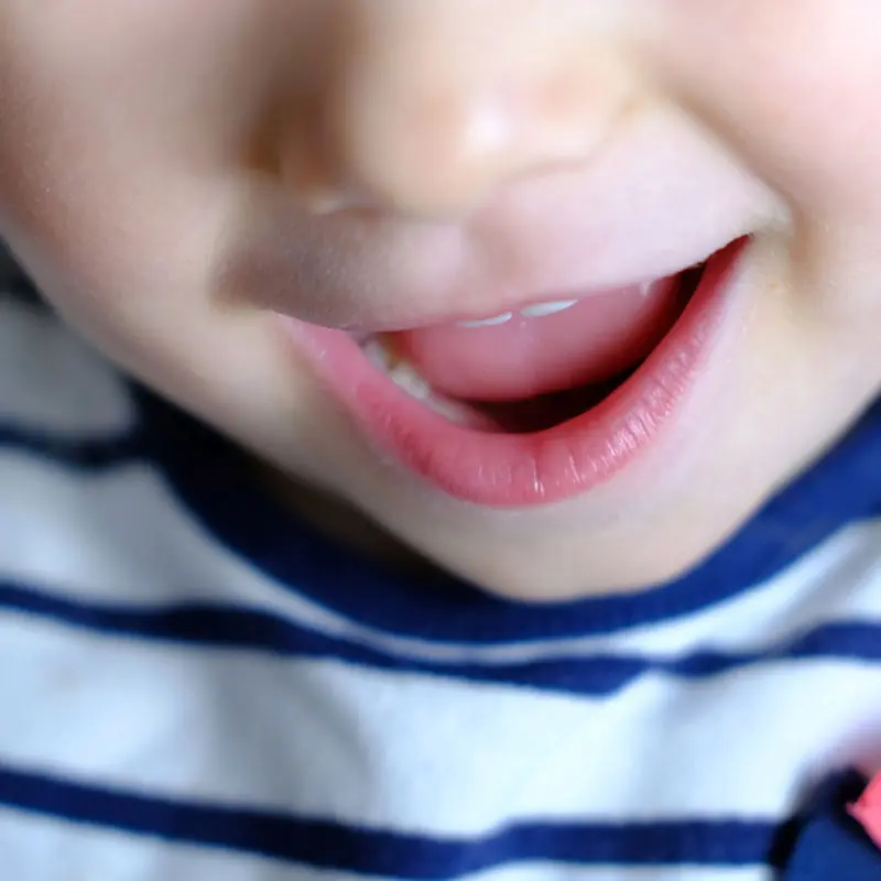 close up shot of child's mouth - Lake Sammamish Kids Dentistry