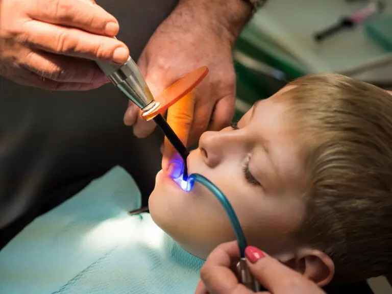 At Lake Sammamish Kids Dentistry - Pediatric Dentist in Sammamish WA, a child undergoes a gentle dental procedure with a curing light tool, illustrating how early cavity detection enables smaller fillings and less invasive treatments.