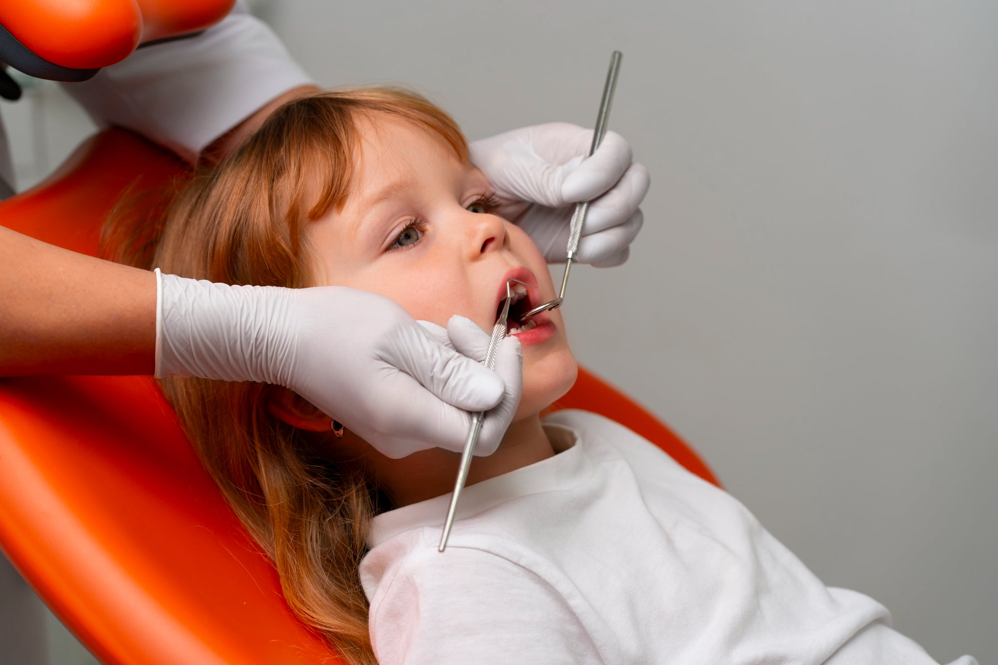 At Lake Sammamish Kids Dentistry - Pediatric Dentist in Sammamish WA, a child comfortably sits in an orange dental chair as the dentist uses advanced tools to perform a quick, stitch-free CO₂-laser frenectomy—examining and treating her teeth in just two minutes.