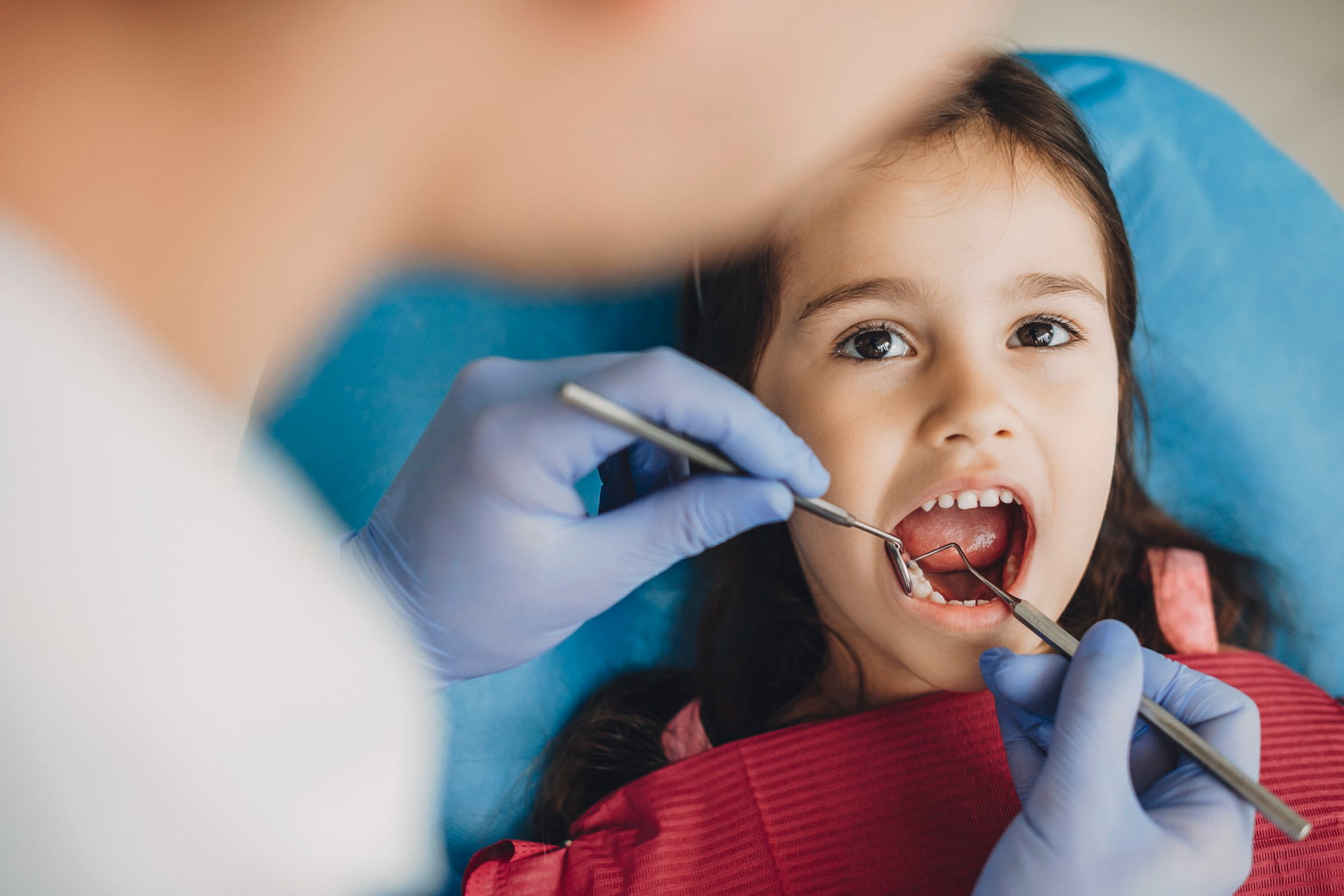 At Lake Sammamish Kids Dentistry - Pediatric Dentist in Sammamish WA, a dentist gently examines a young girl’s teeth, providing comforting restorative dental care for anxious children.