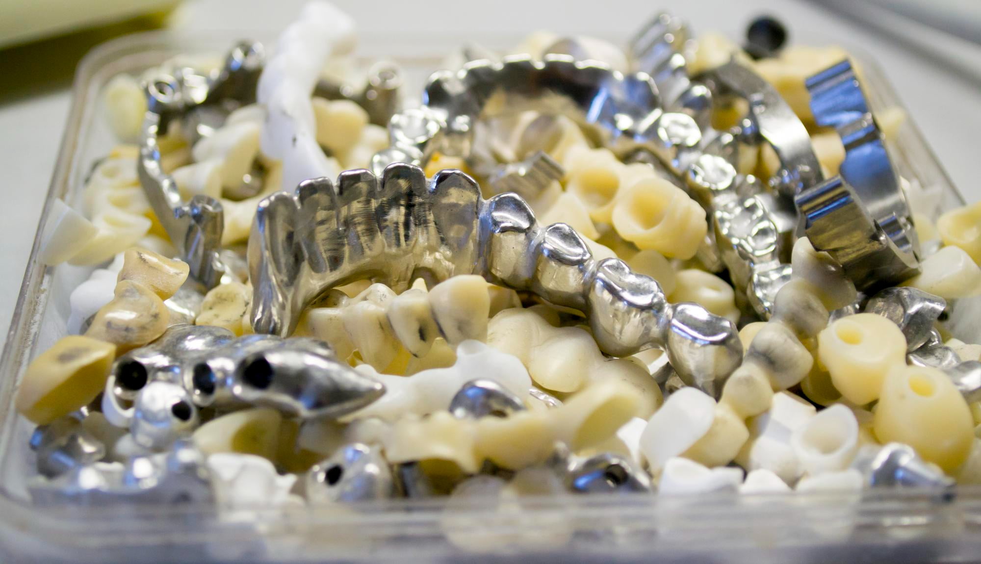 A container holds various dental prosthetics at Lake Sammamish Kids Dentistry - Pediatric Dentist in Sammamish WA, including zirconia and stainless-steel crowns for restorative pediatric care, along with ceramic and metal dental bridges.
