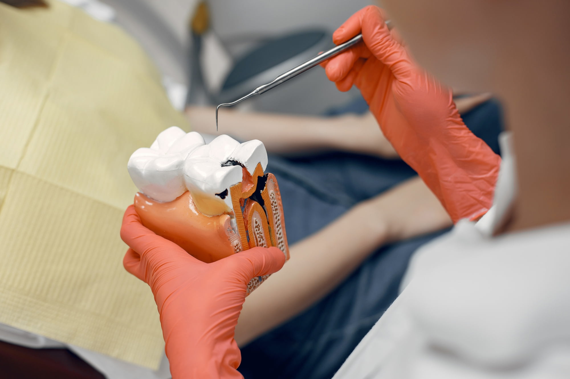At Lake Sammamish Kids Dentistry - Pediatric Dentist in Sammamish WA, a dentist wearing orange gloves uses a dental tool to indicate a cavity on a large tooth model, emphasizing the role of dental sealants in preventing cavities while a patient sits nearby.