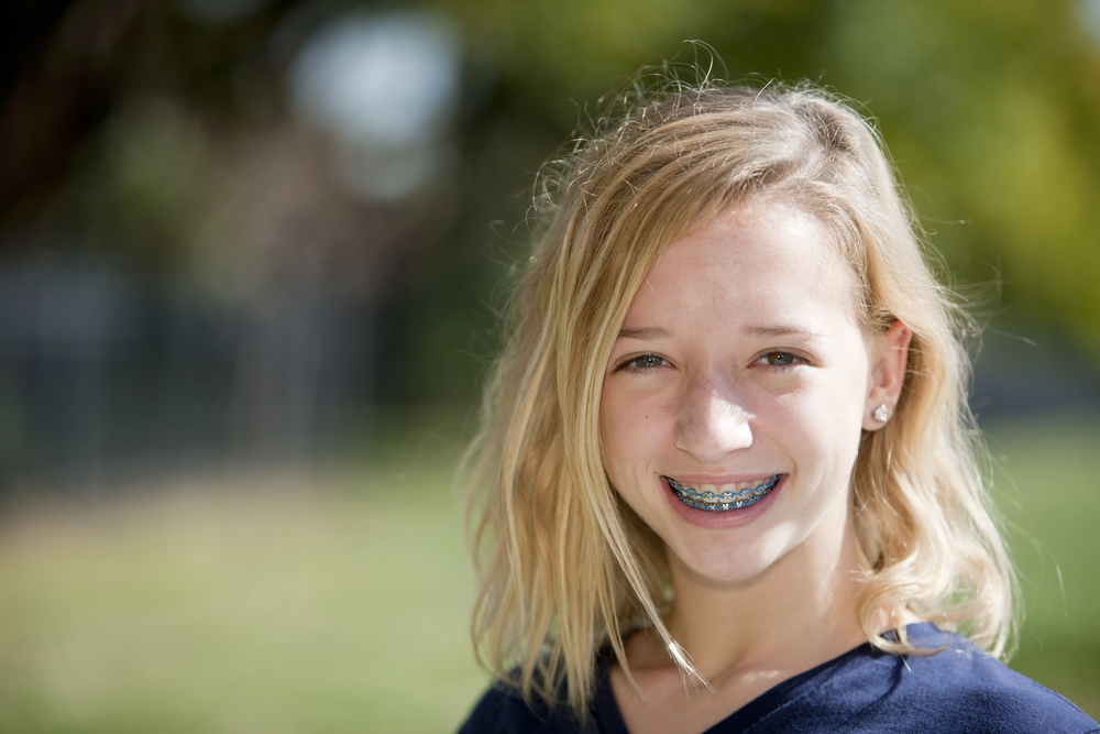 A smiling young person with blonde hair and braces stands outside in a dark shirt, highlighting the benefits of Apple Health Dental Coverage for Kids in Sammamish, WA, at Lake Sammamish Kids Dentistry - Pediatric Dentist  against a blurred green backdrop.