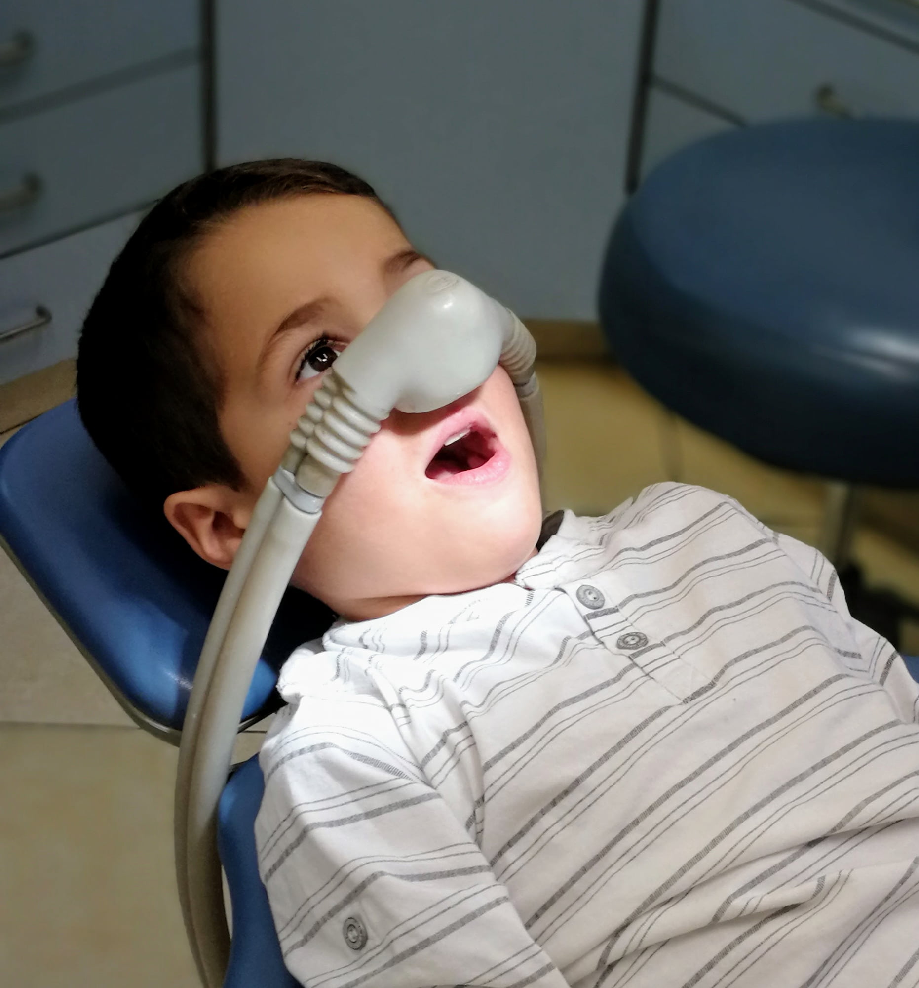 At Lake Sammamish Kids Dentistry - Pediatric Dentist in Sammamish WA, a child in a striped shirt is seated in a dental chair with a nitrous oxide mask, receiving Oral Conscious Sedation for a comfortable and calming experience.